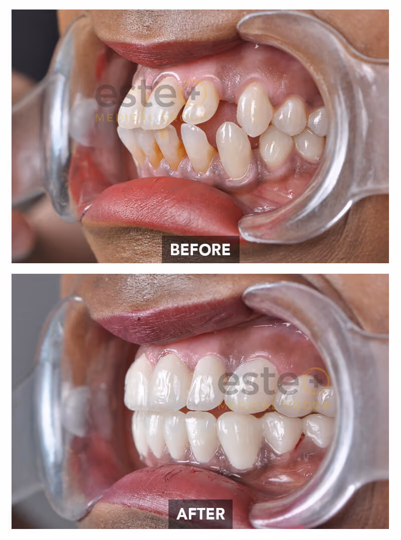 Nima - Dentistry Before after images