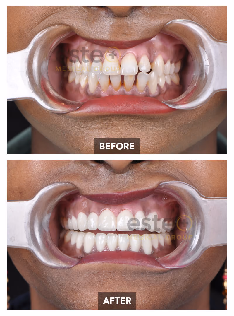Nima - Dentistry Before after images