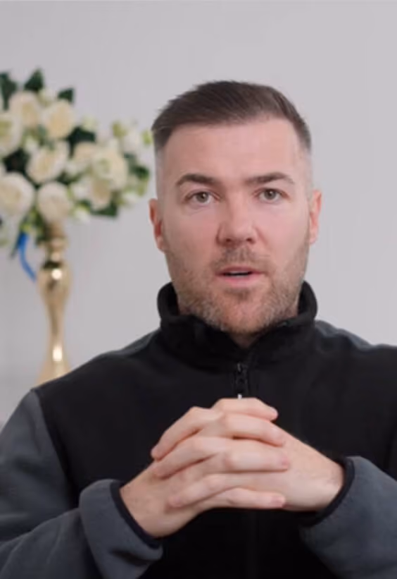 Sean 2 years post hair transplant - Este Medical