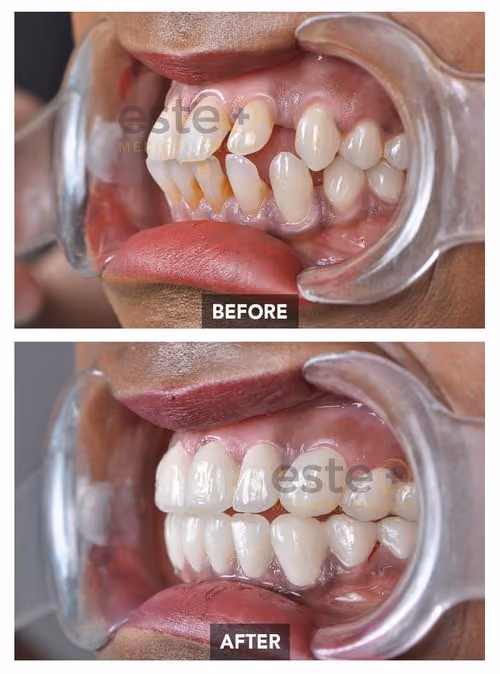 Dentistry Before-after Images - Este