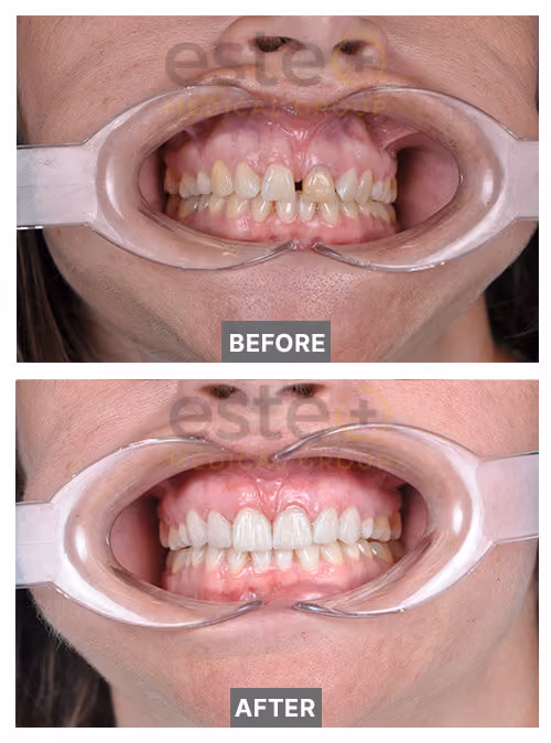 Kristy before after results 