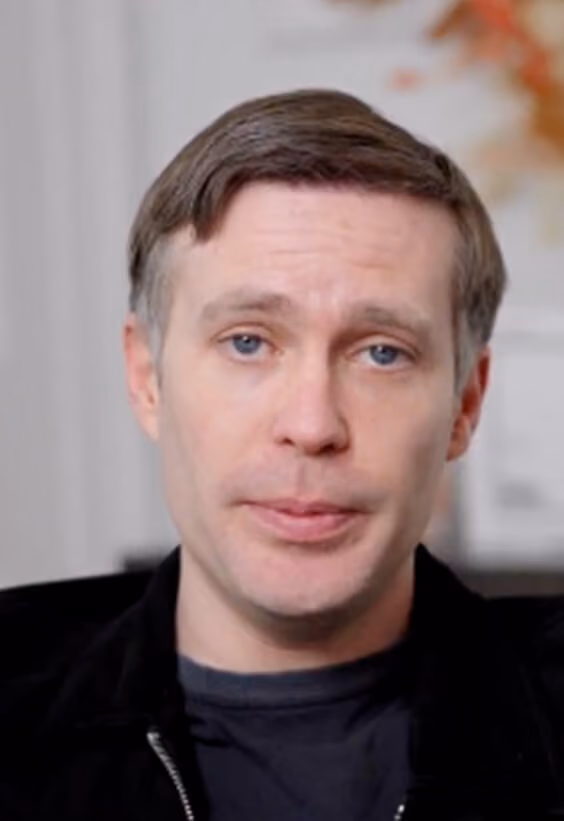 Dane Macaulay - Hair Transplant before after images - Este