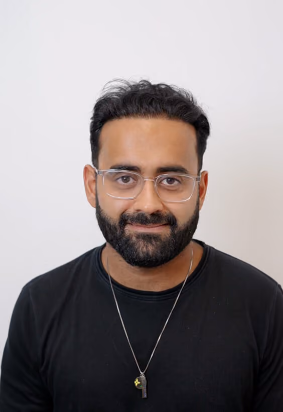 Rish's Hair Transplant results with Este Medical