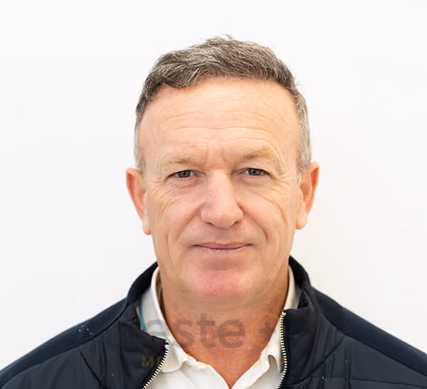 Hair Transplant Male