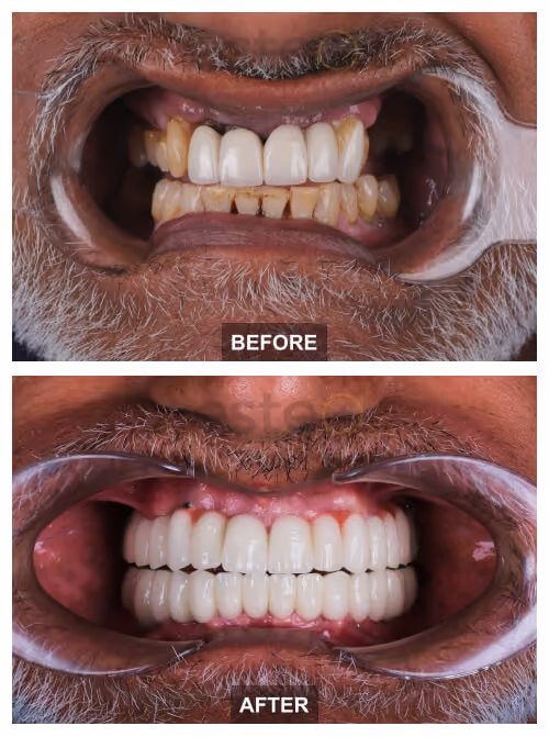 Kully's dental treatment with Este Medical