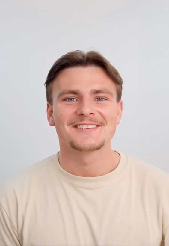 Hair Transplant Male