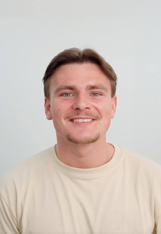 Hair Transplant Male