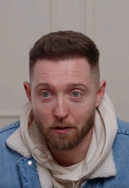 Martin Hair Transplant story image