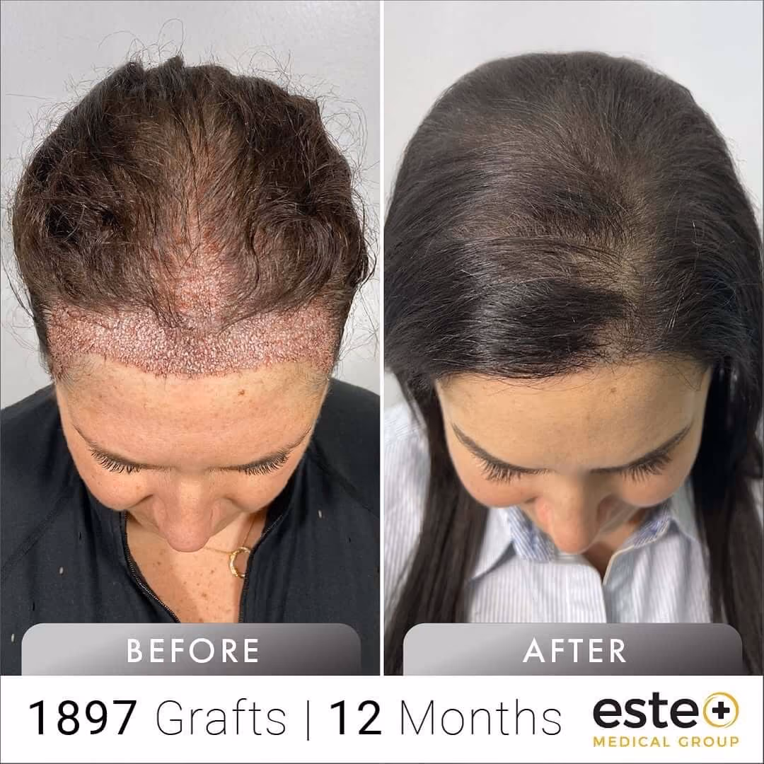 female_Before and after images