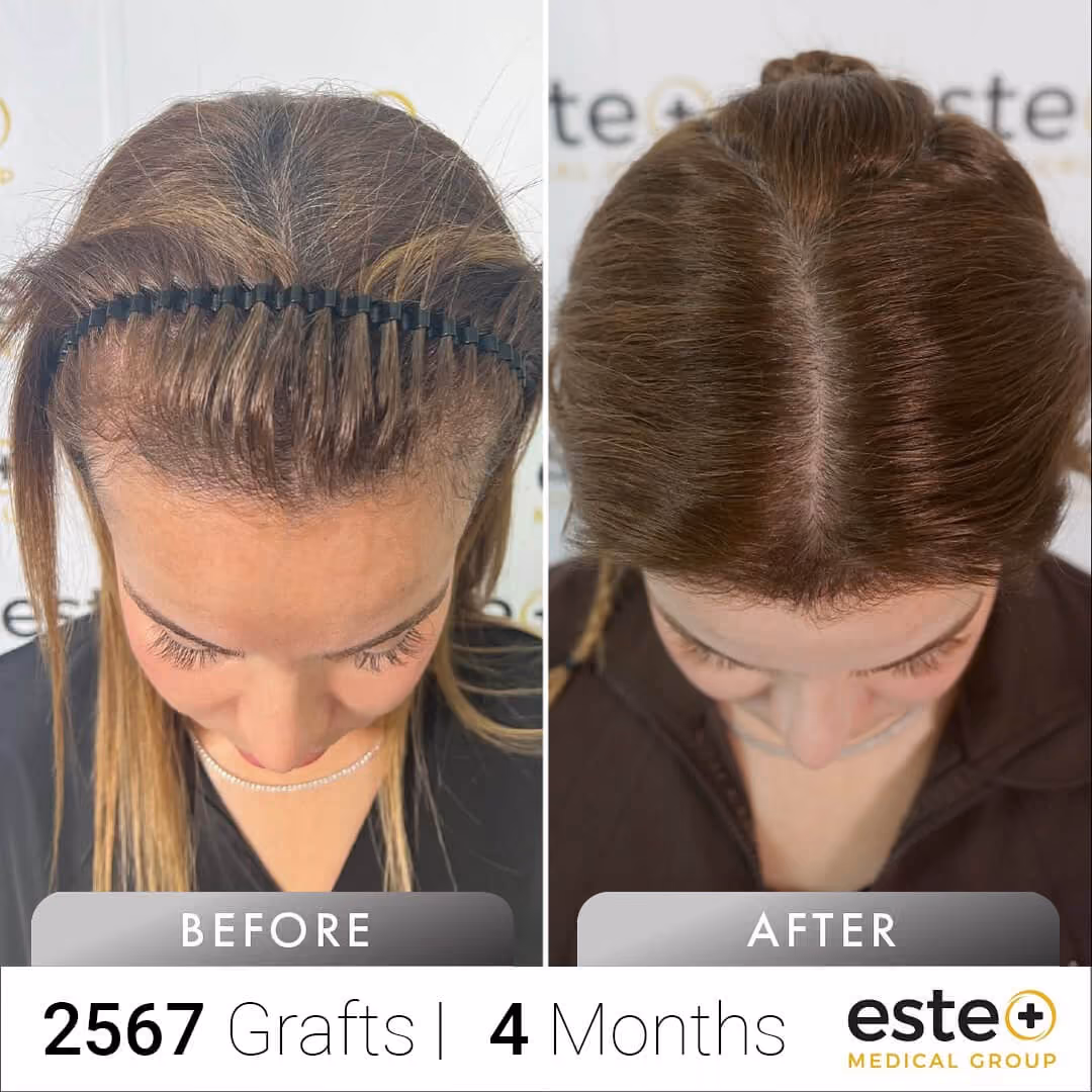 female_Before and after images