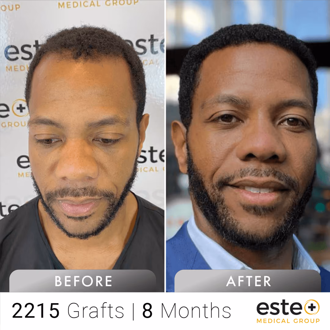 Afro_Before and after images