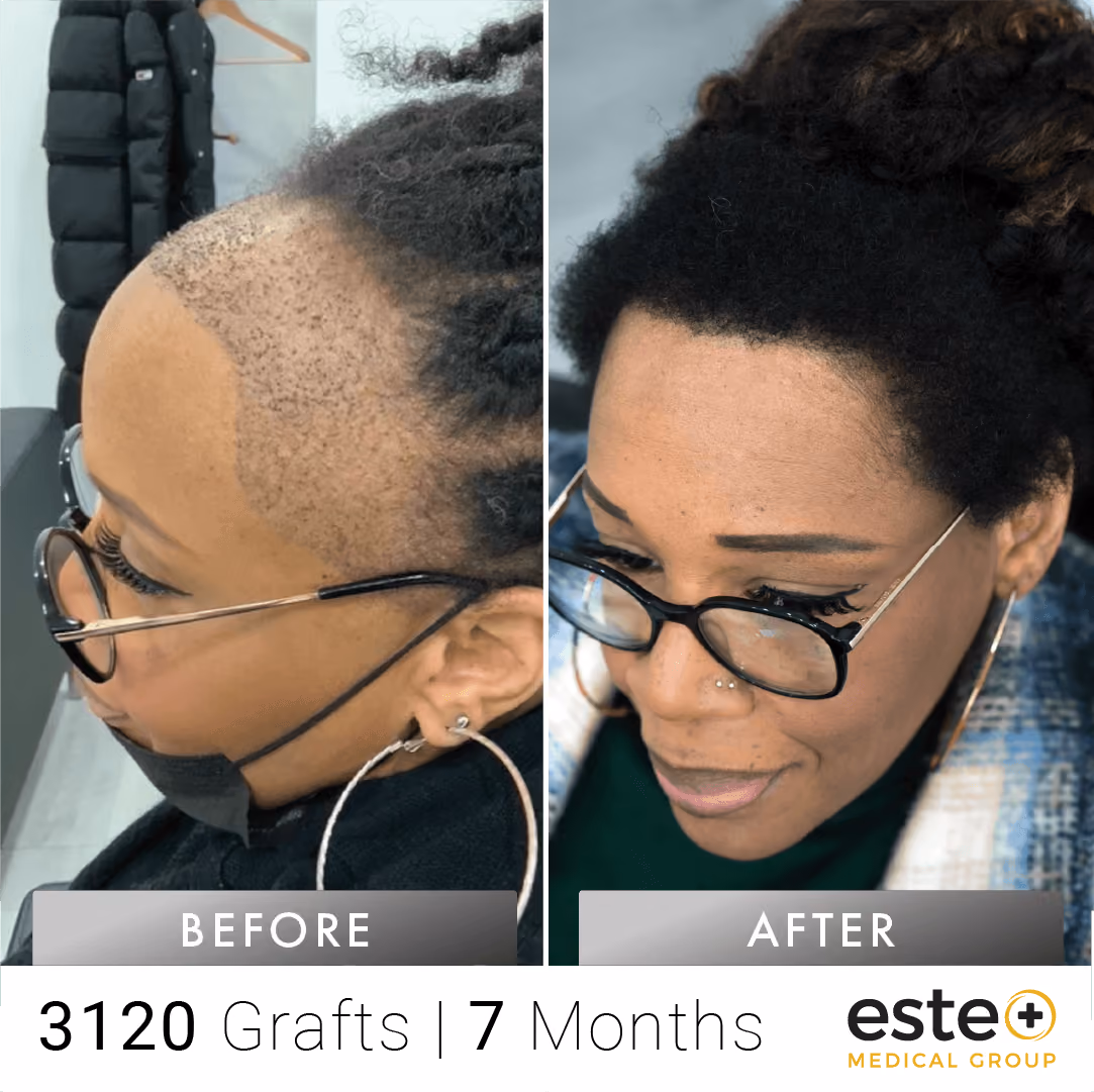 Afro_Before and after images
