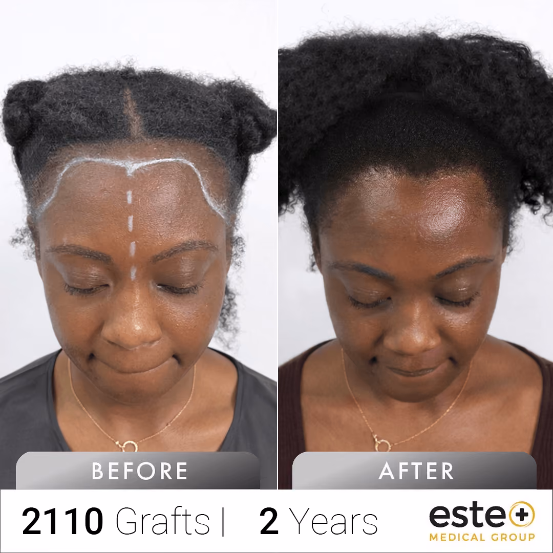 Afro_Before and after images