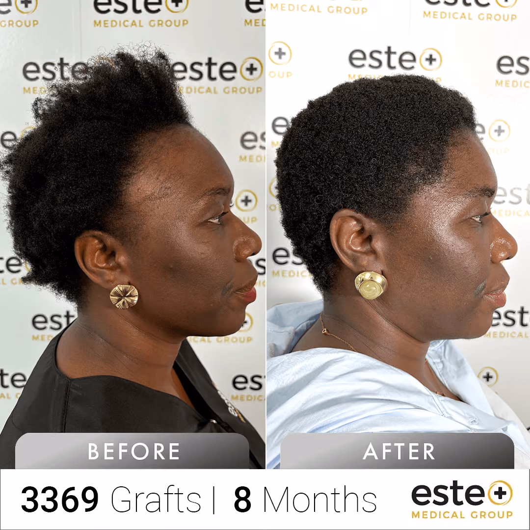 Afro_Before and after images