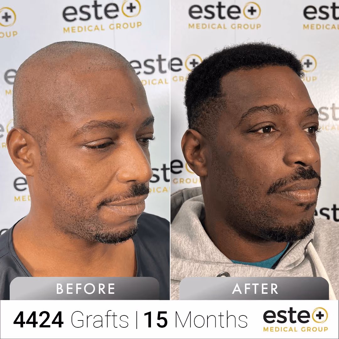 Afro_Before and after images