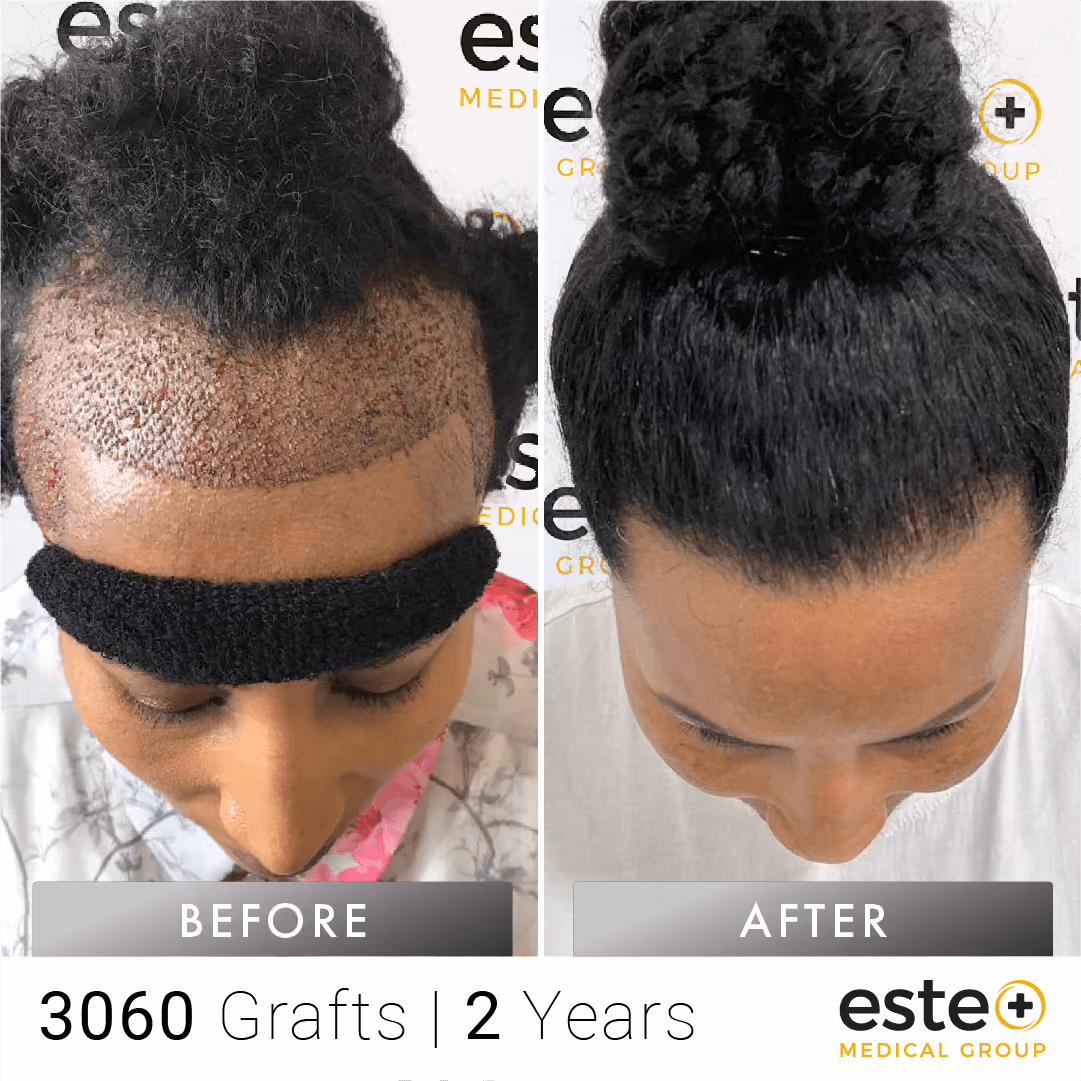 Afro_Before and after images