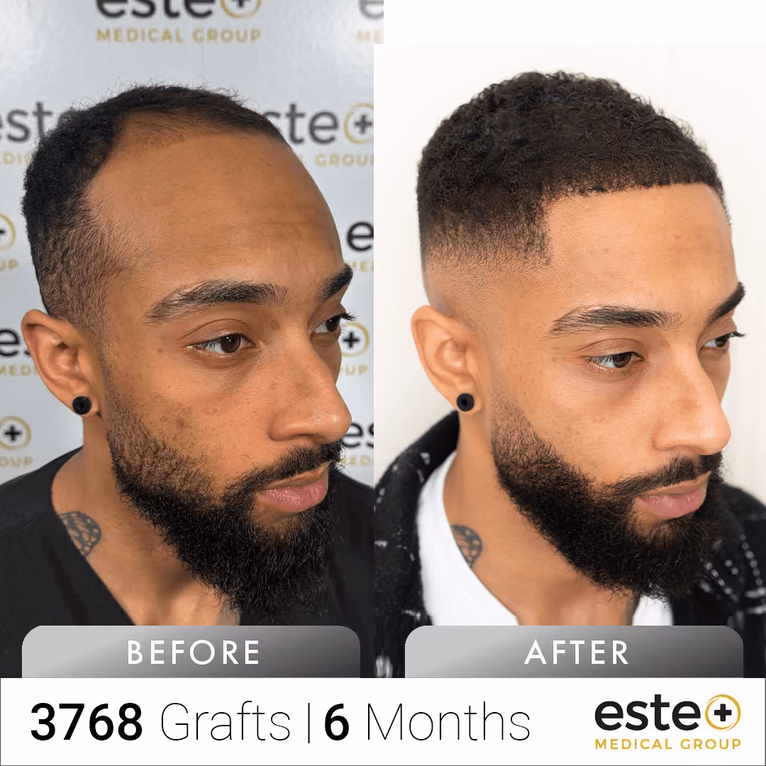 Afro_Before and after images