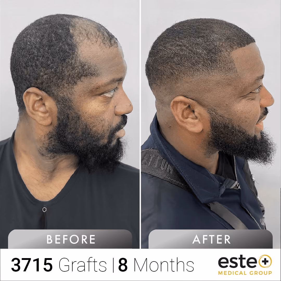 Afro_Before and after images
