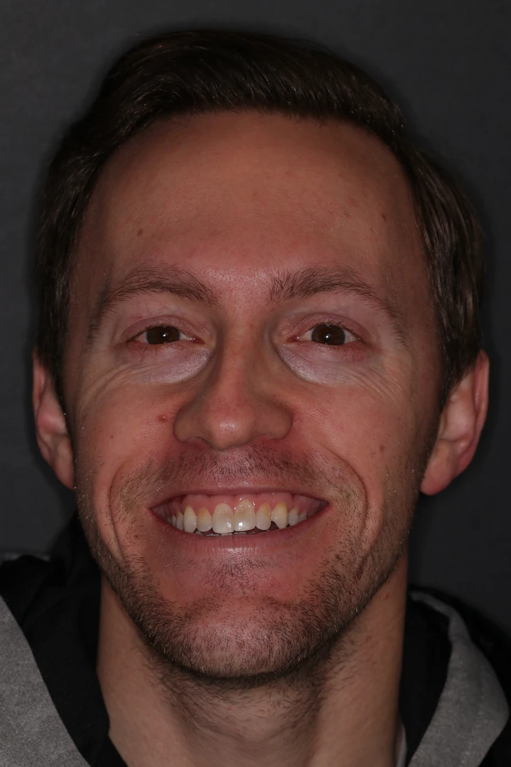 before and after treatment