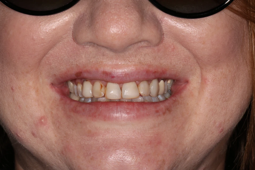 before and after treatment