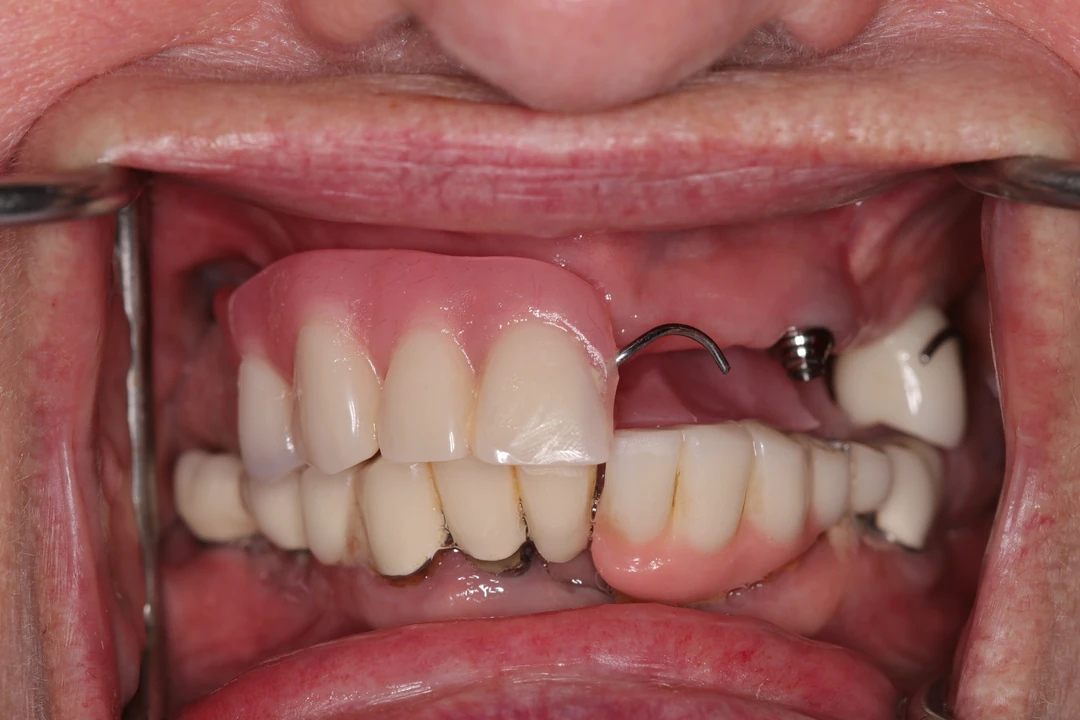 before and after treatment
