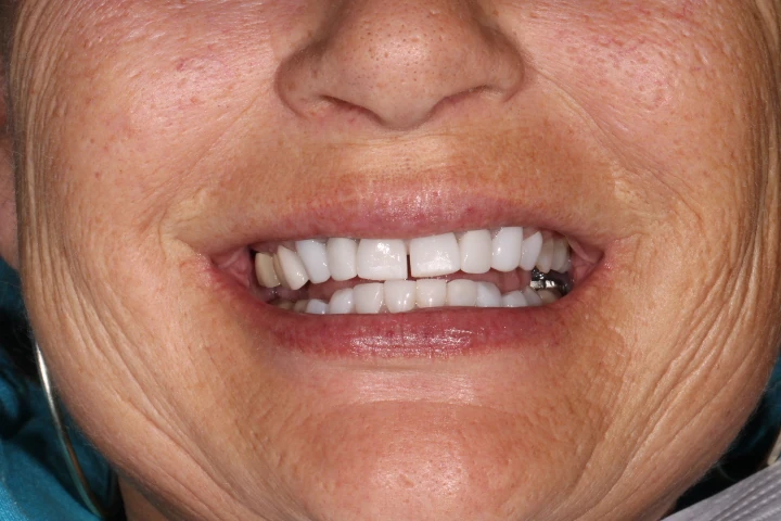 before and after treatment
