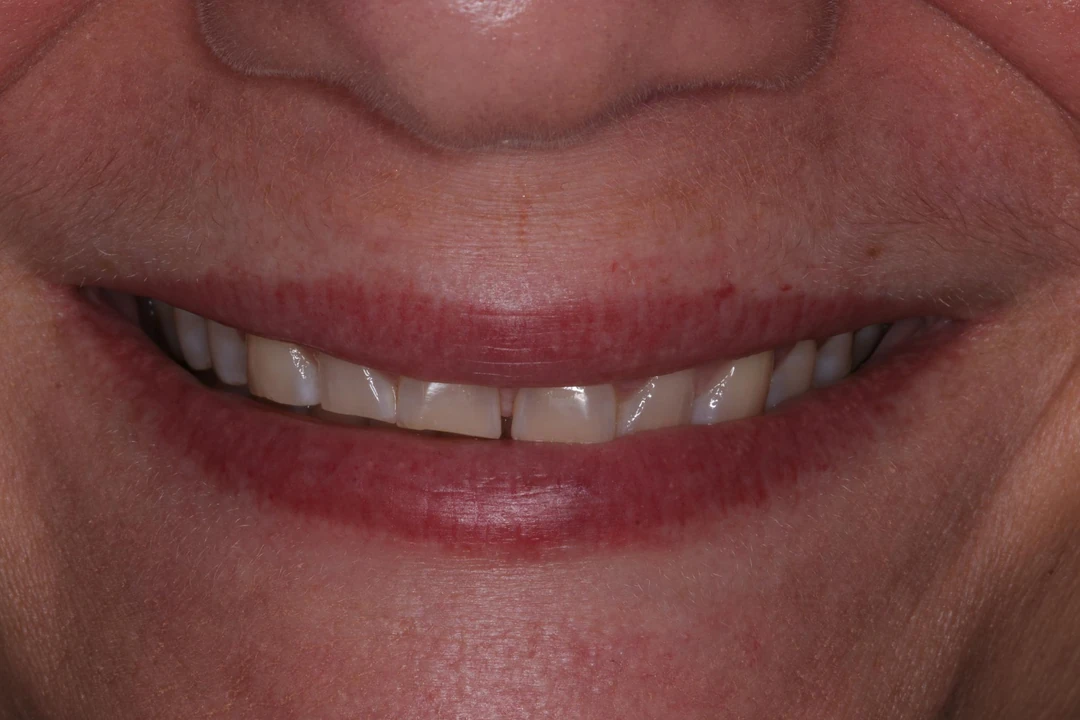 before and after treatment