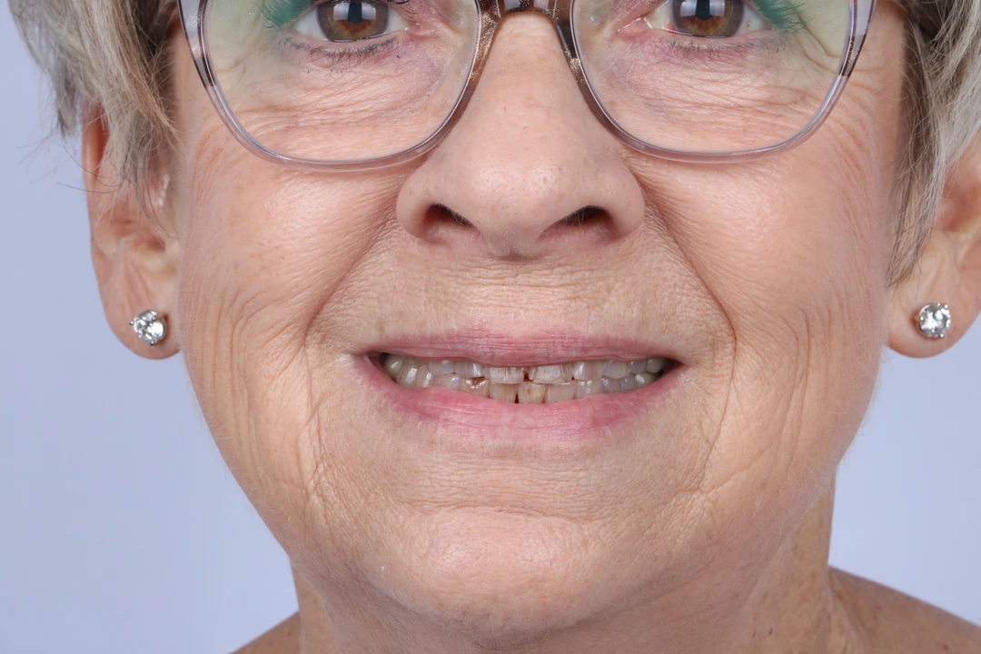 before and after treatment
