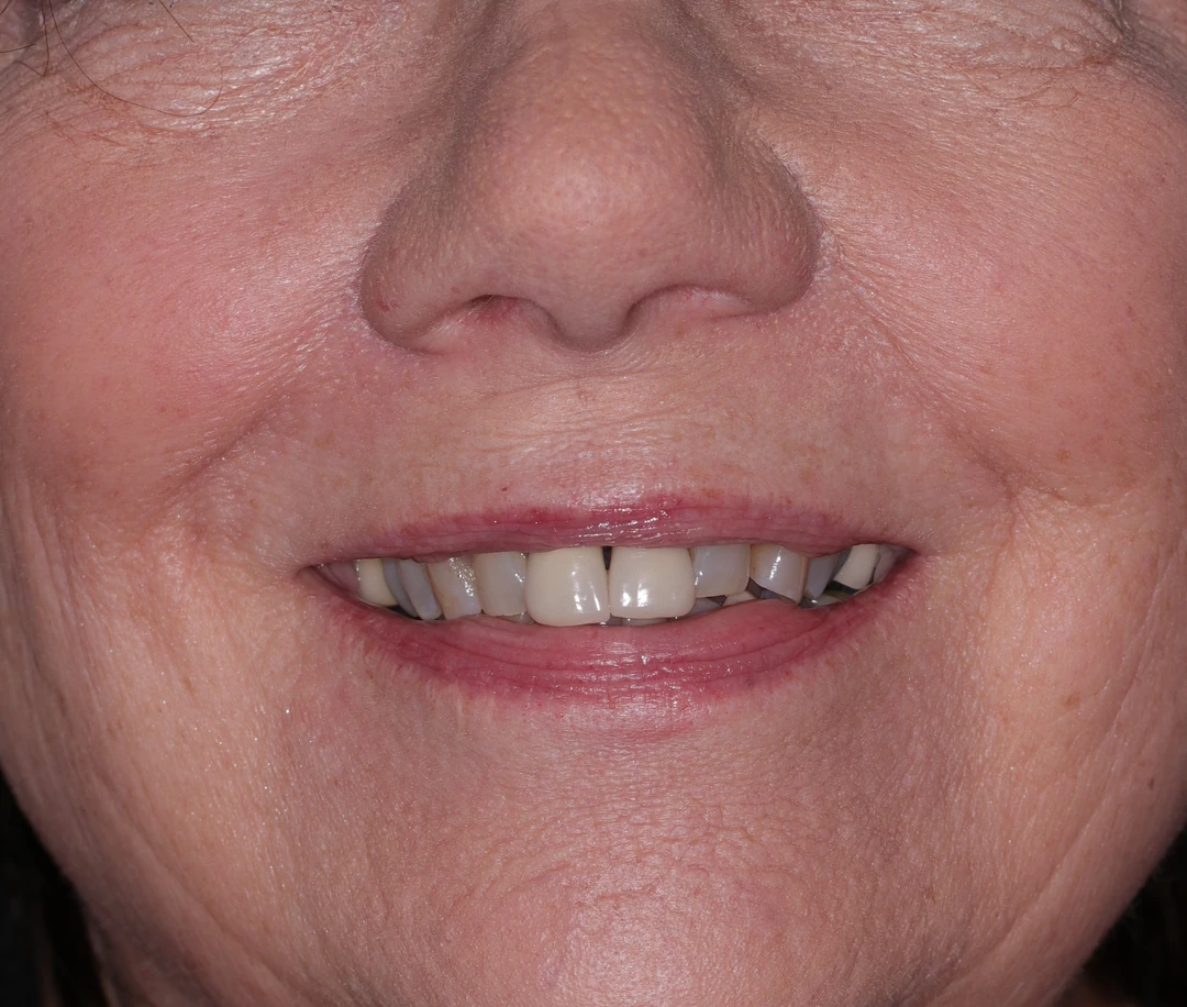 before and after treatment