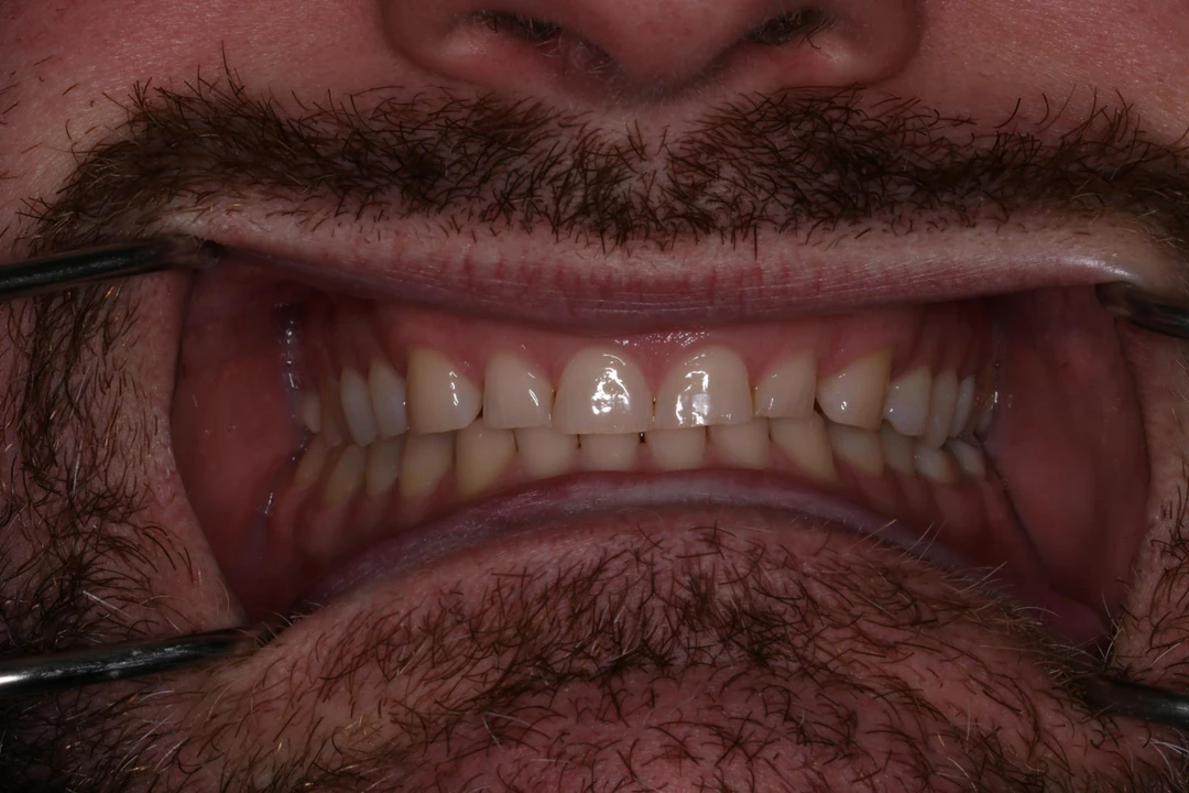 before and after treatment