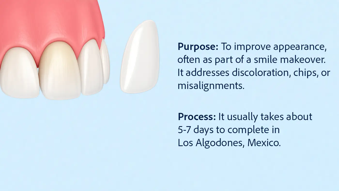 Illustration of a Porcelain veneer being applied to a front tooth, explaining the cosmetic purpose and process in Los Algodones.