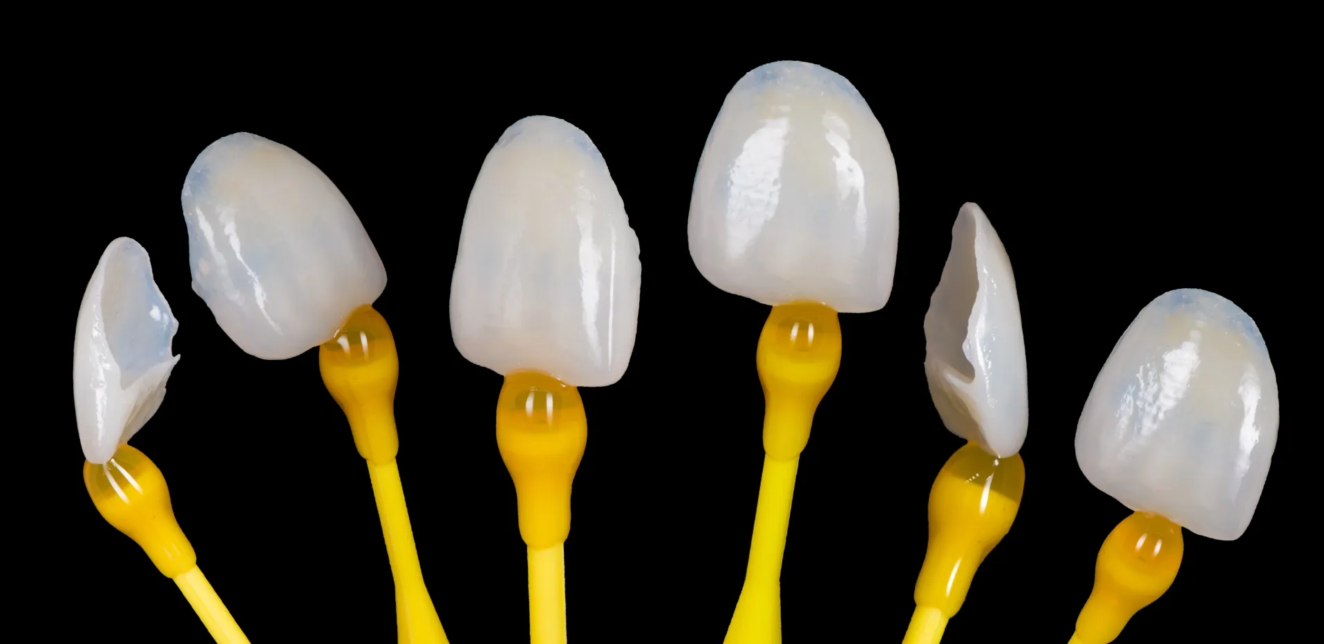 Verschiedene Veneers auf einer Halterung zum Vergleich