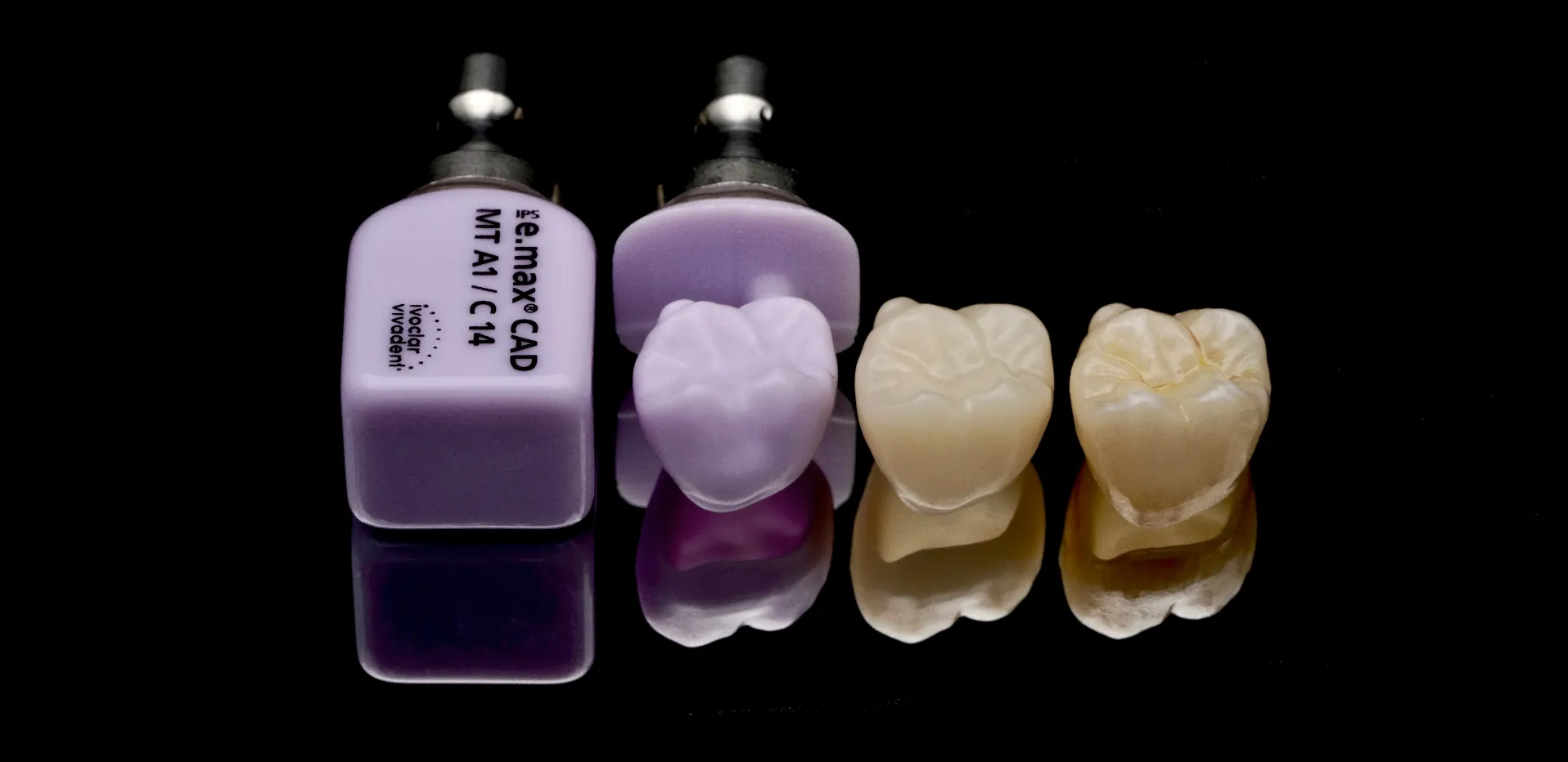 Premiumbehandlung mit dem CEREC-System von Dentsply Sirona in Frankfurt.