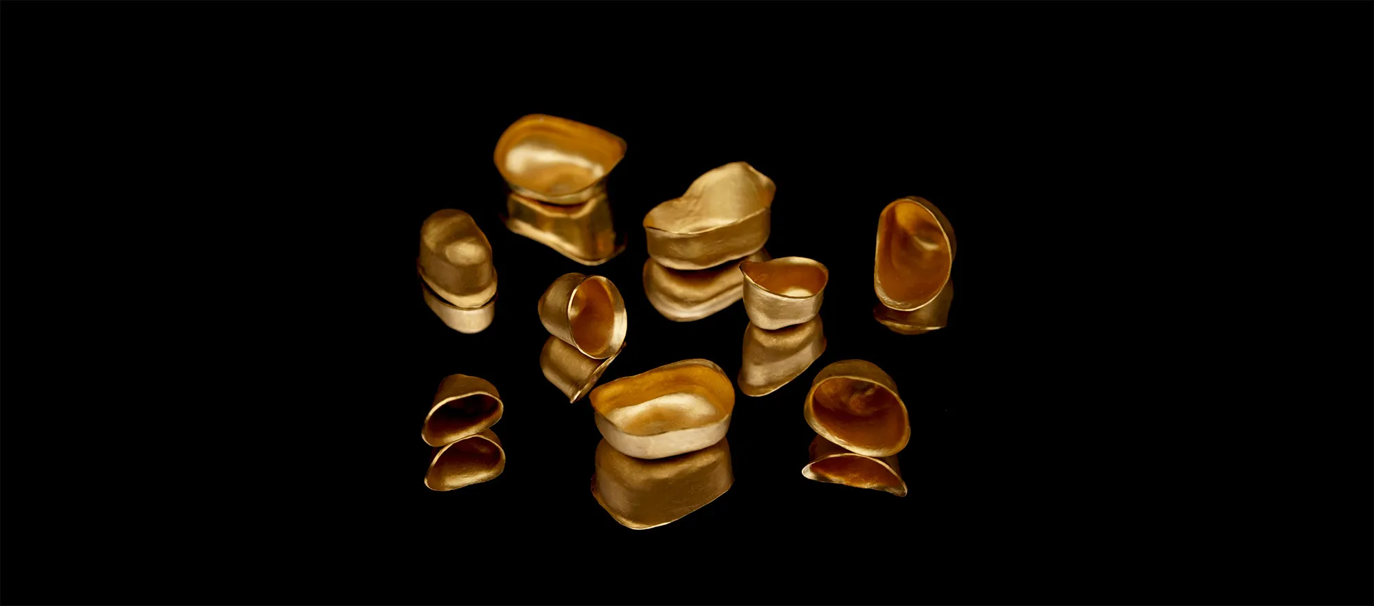 Galvano-Teleskopprothese aus Gold und Keramik