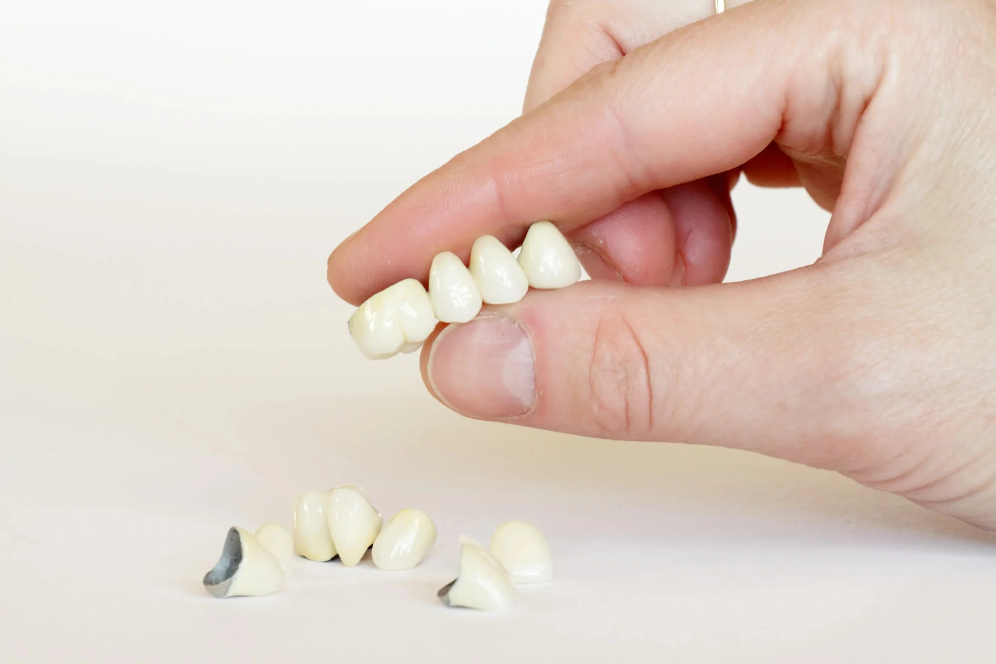 dental bridge model dental bridges in Knoxville, TN