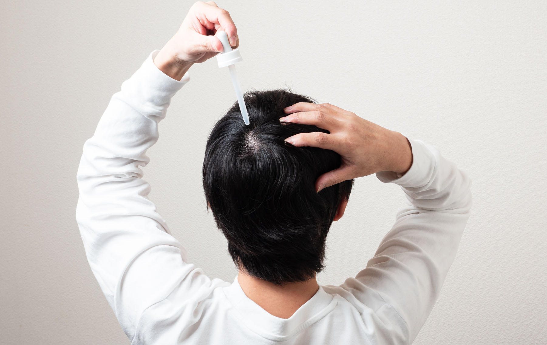 A man holding a medicine dripper up to the crown of his head - about to apply a solution to his hair