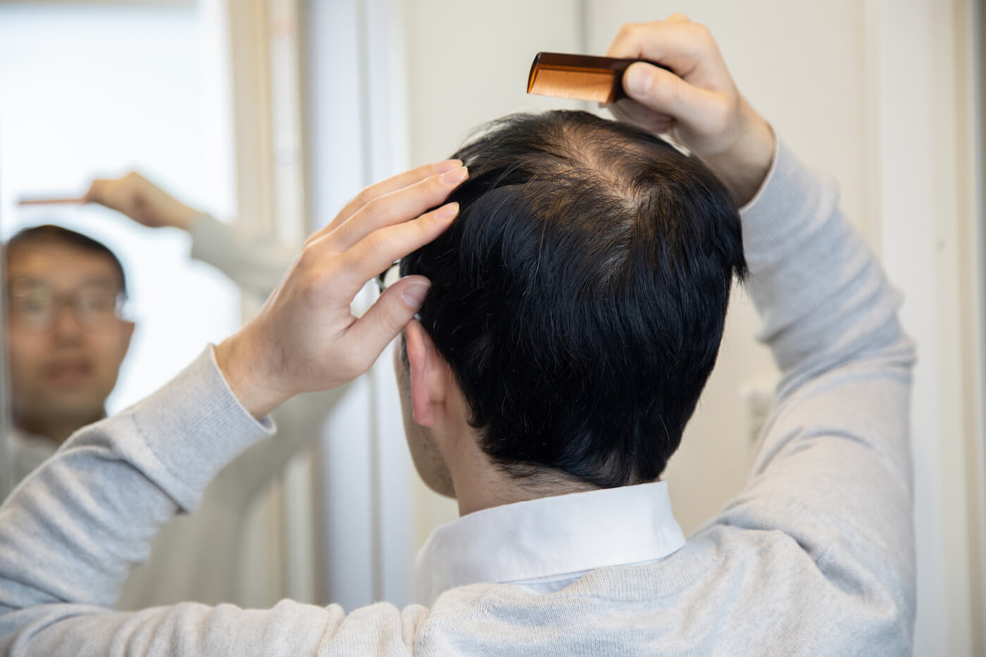 Middle-aged Asian man combing his hair with visible signs of baldness