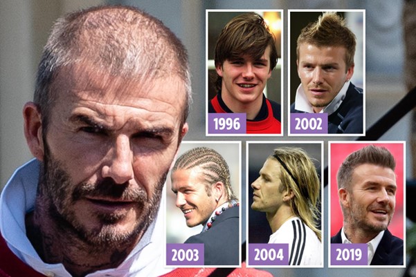 David Beckham's Hair Transplant Journey