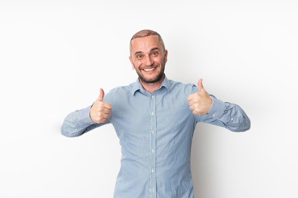  Post Hair Transplant Care