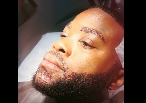 Cameron Afro Beard & Eyebrow Transplant 