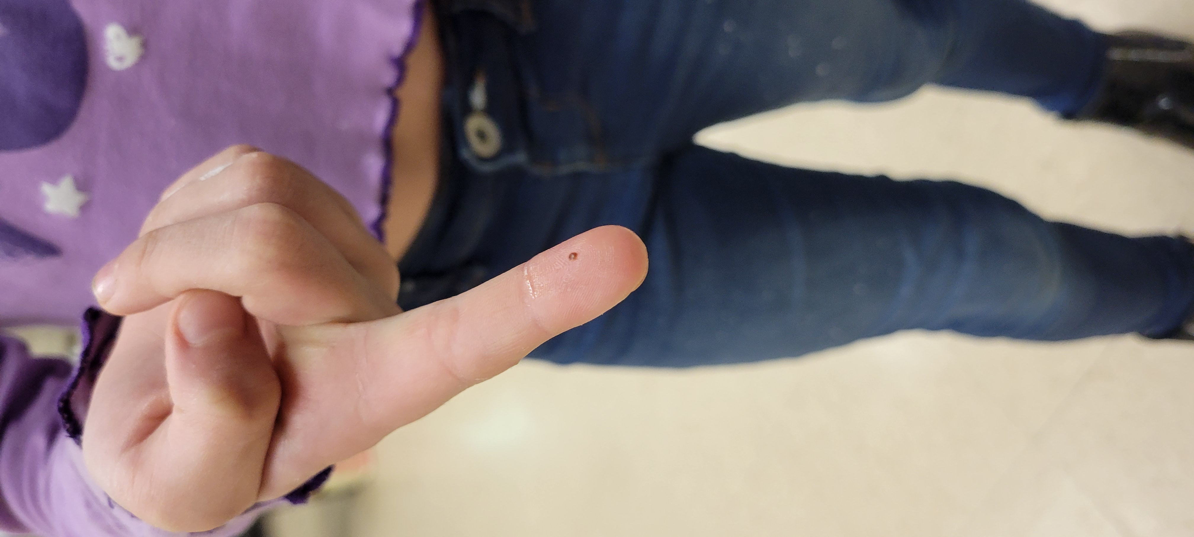 Mites,Mites and More Mites!