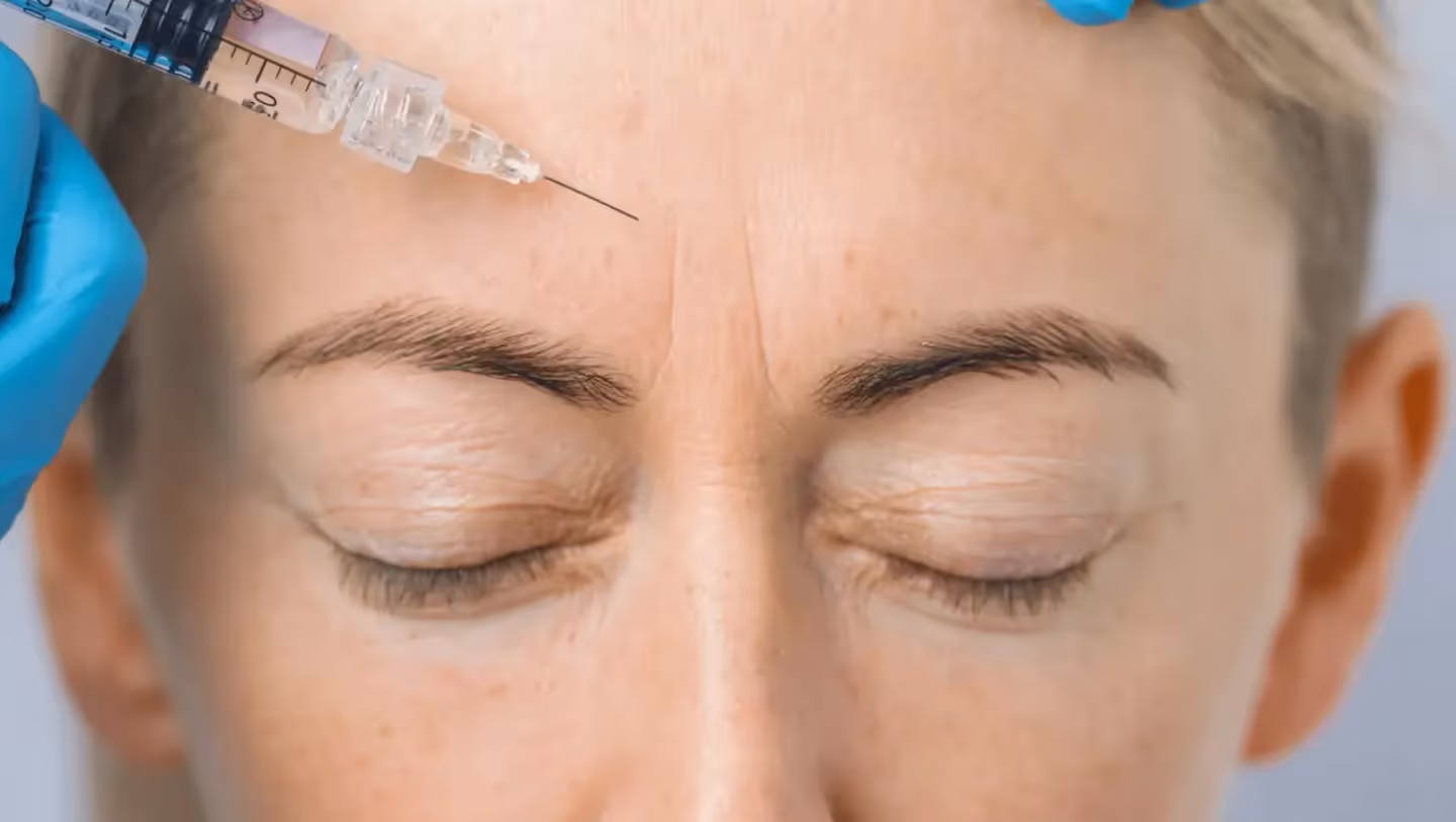 Bellafill® 101: Advantages, Attracting Medspa Clients & More