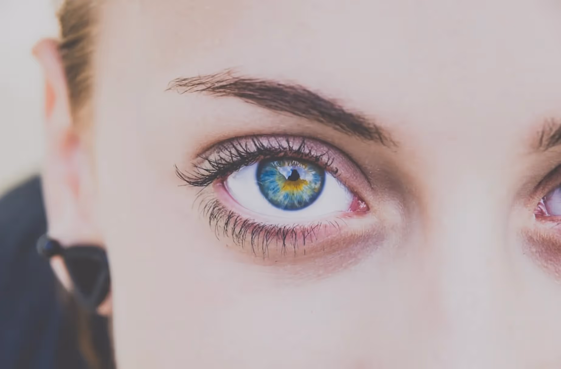 Botox Brow Lift 101: A Marketable Medspa Procedure