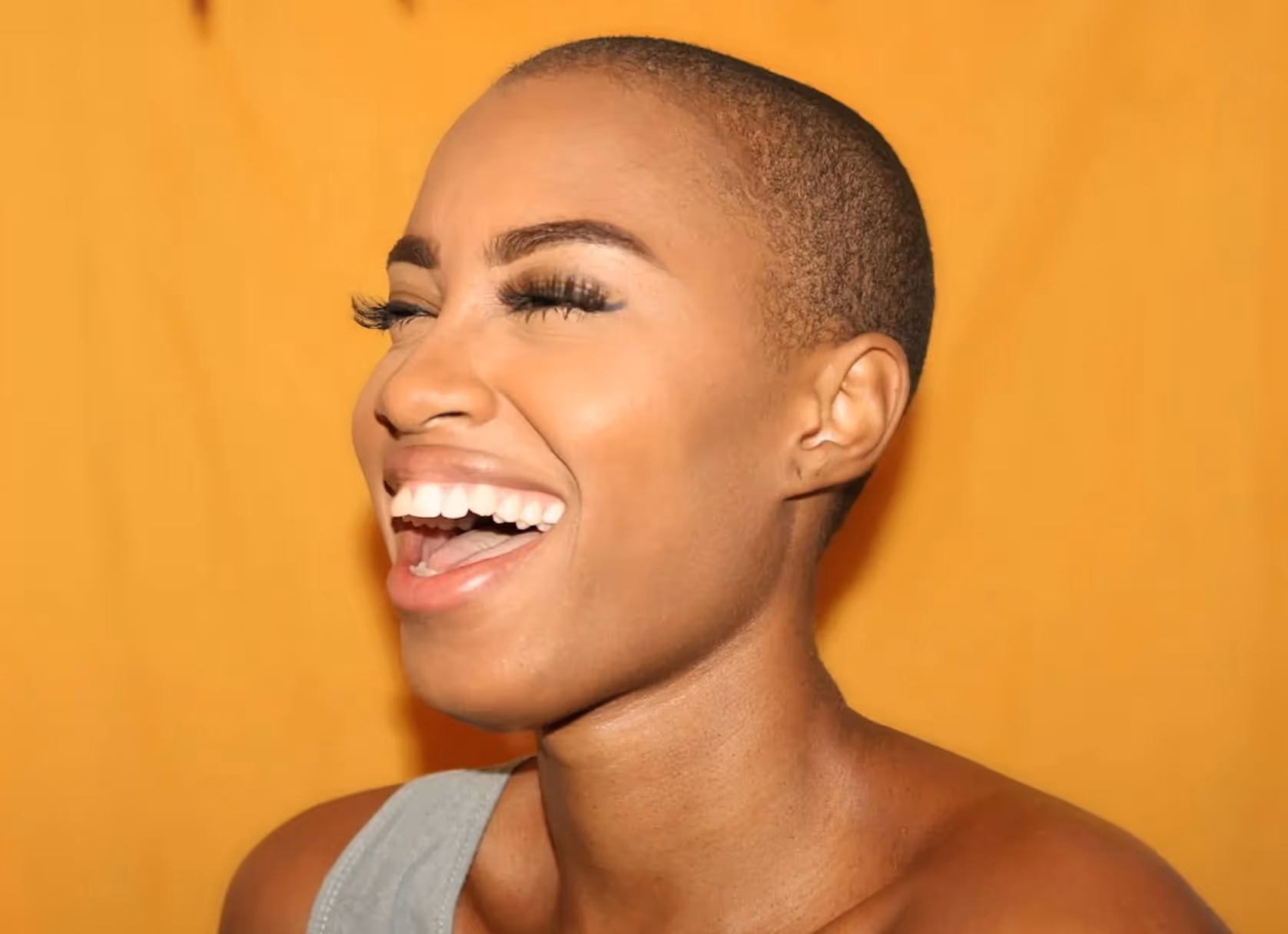 Gummy Smile Correction with Botox 101
