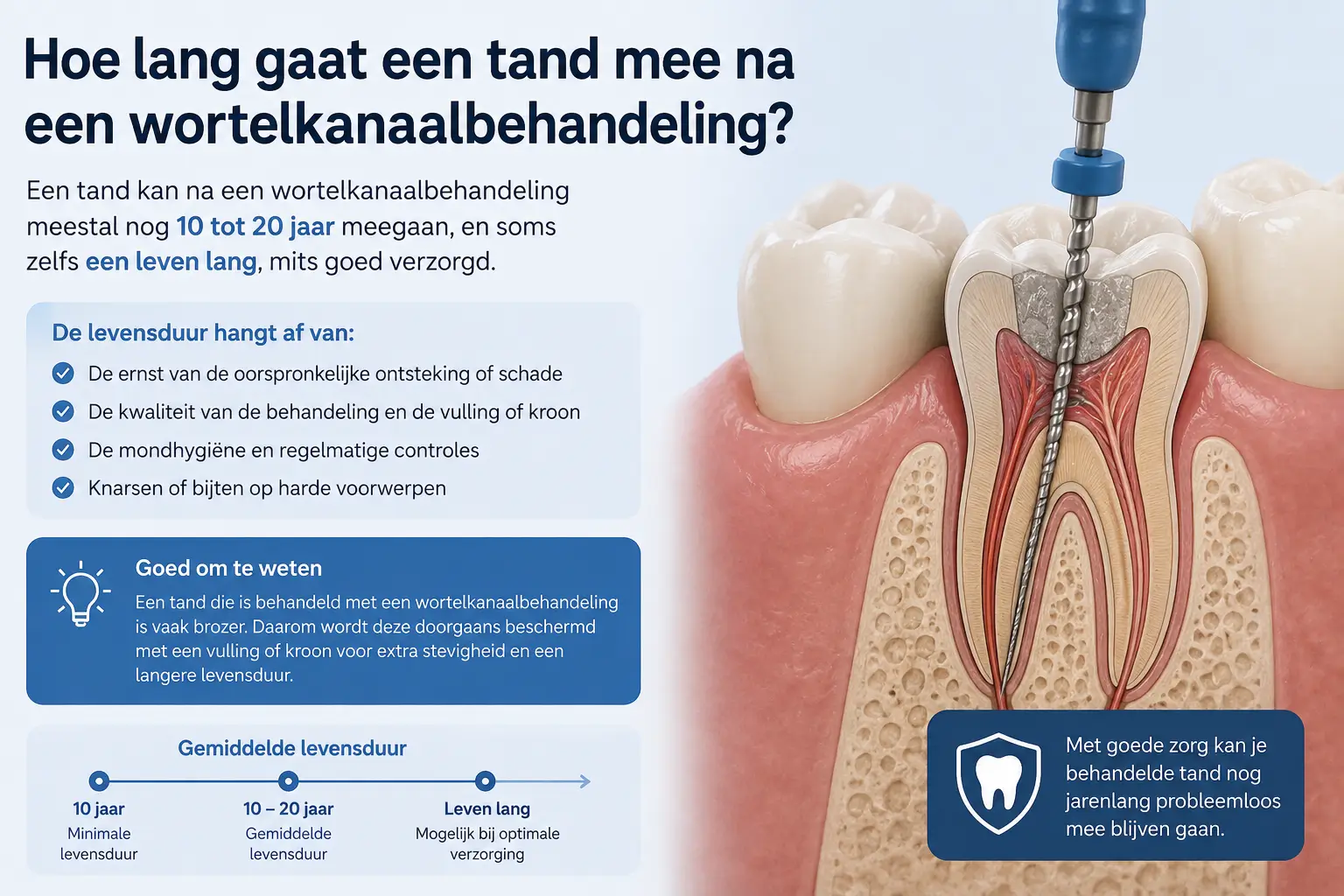 Hoe lang gaat een tand mee na een wortelkanaalbehandeling?