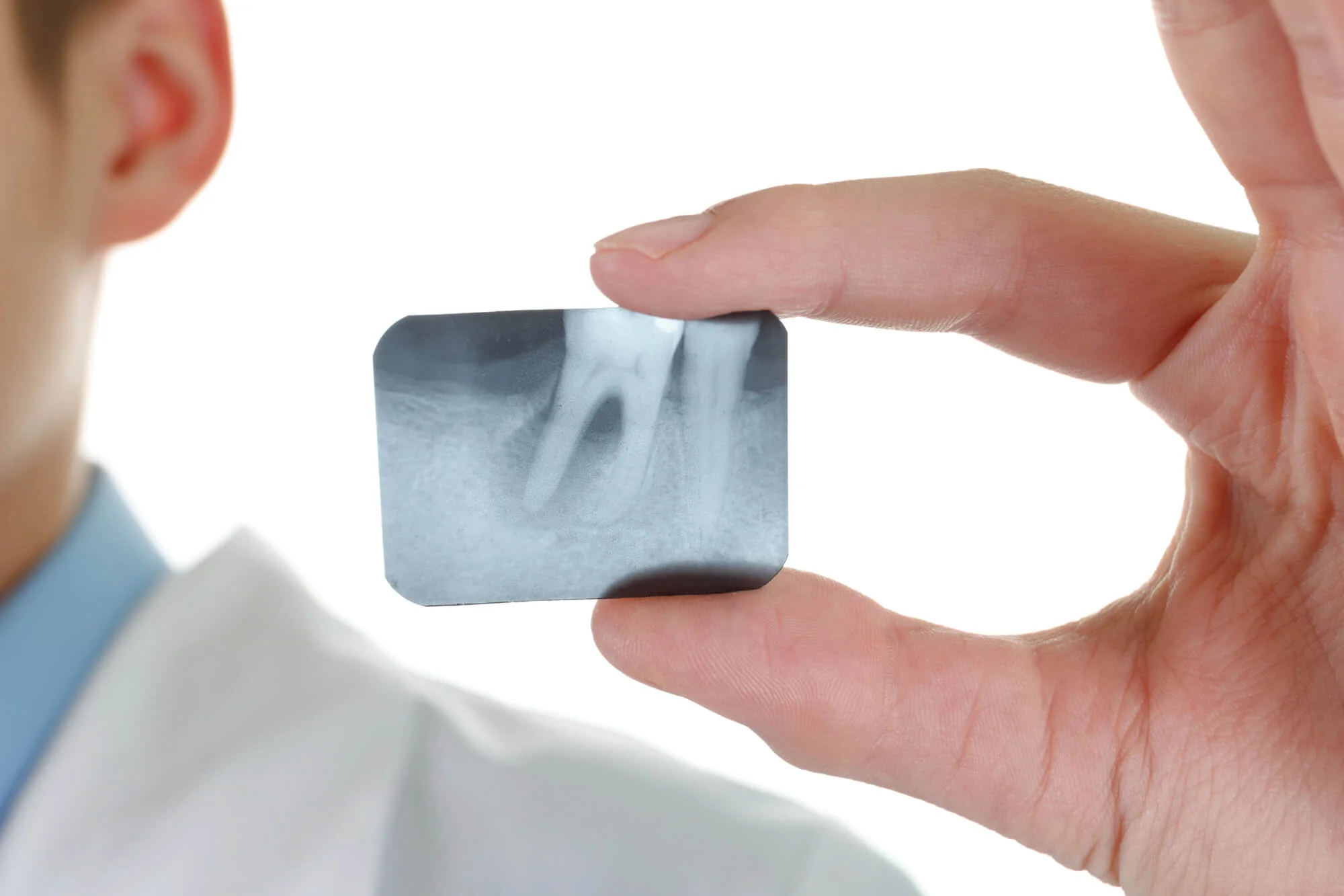 Dental X-ray showing tooth root, Periodontists Nashville, TN