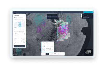 Screenshot of PyxaStudio showing the region selection interface on a mouse brain tissue scan, with Z-slice range controls, region data metrics, and a contextual how-to panel for refining the selected area.