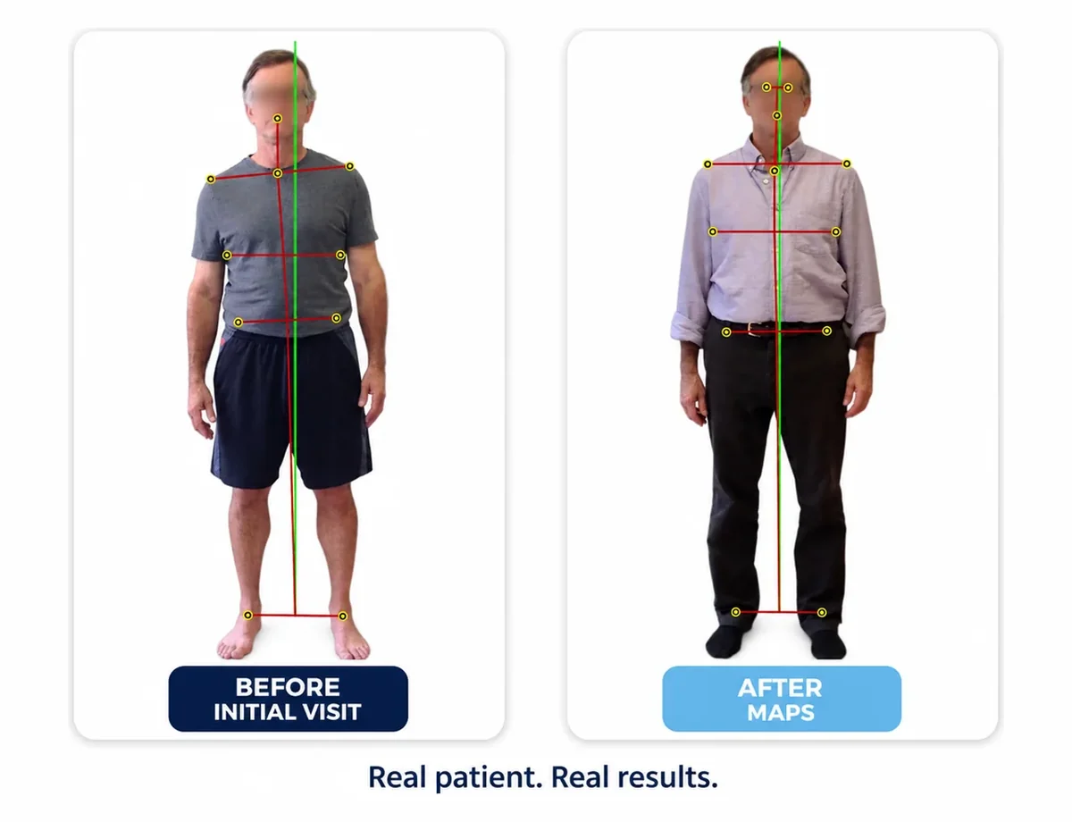 Before and after alignment correction — real MAPS patient, body recentered over its midline