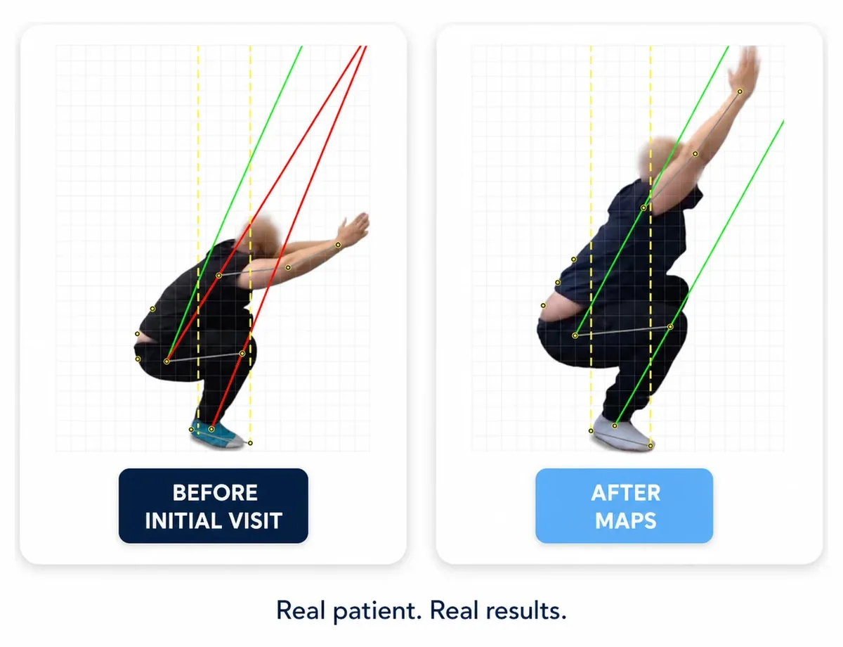 Before and after squat assessment — real MAPS patient, torso and shins realigned parallel under load