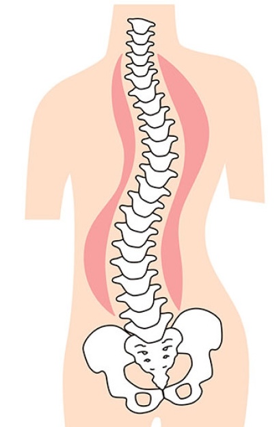 Posturologie neuro sensorielle